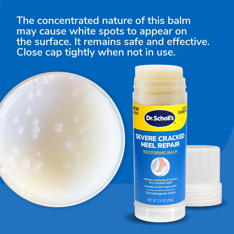 Dr. Scholl's Severe Cracked Heel Repair Restoring Balm 2.5oz, with 25% Urea for Dry, Cracked Feet, Heals and Moisturizes for Healthy Feet, Epsom Salt Soothes, Safe for Diabetics, 3-pack 1 Count (Pack of 3)