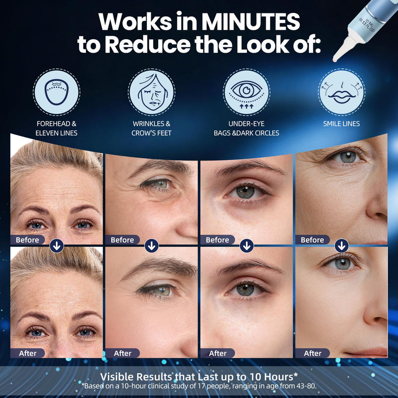 KKP Rapid Reduction Eye Serum & Face Lift Cream - Visibly Reduces Under-Eye Bags, Wrinkles, Dark Circles, Fine Lines & Crow's Feet Instantly, Anti Aging Wrinkle Remover for Face 3PACK - BeesActive Australia