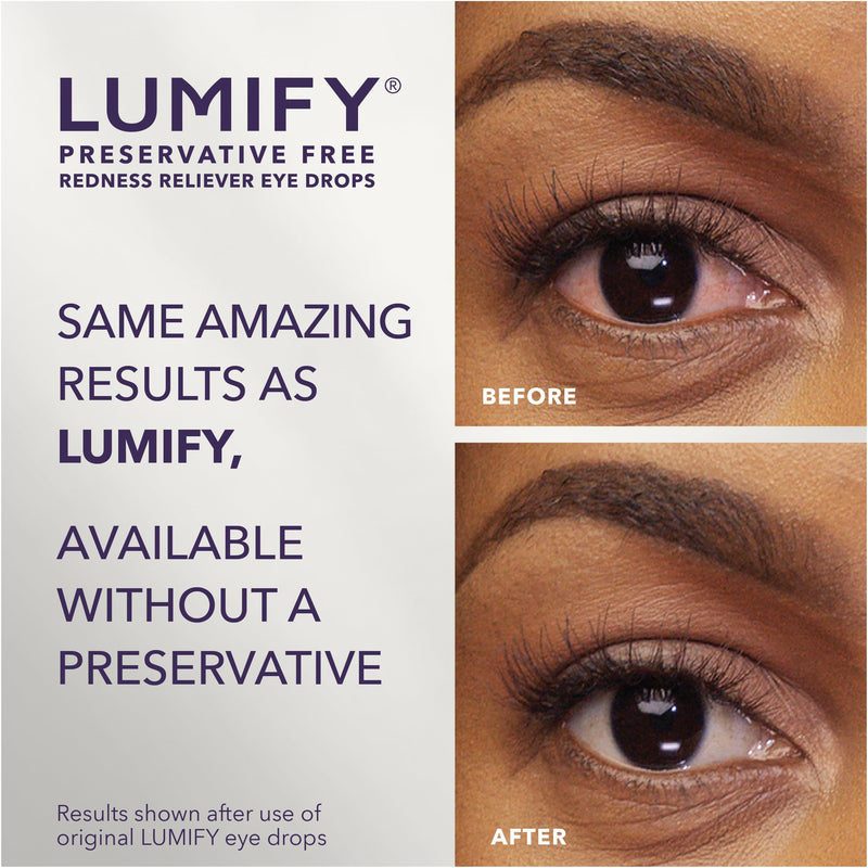 LUMIFY Preservative Free Eye Drops for Red Eyes, Redness Reliever for Sensitive Eye, Brighter and Whiter Looking Eyes, Works in 1 Minute & Lasts Up to 8 Hours, 20 Single-Use Vials - BeesActive Australia