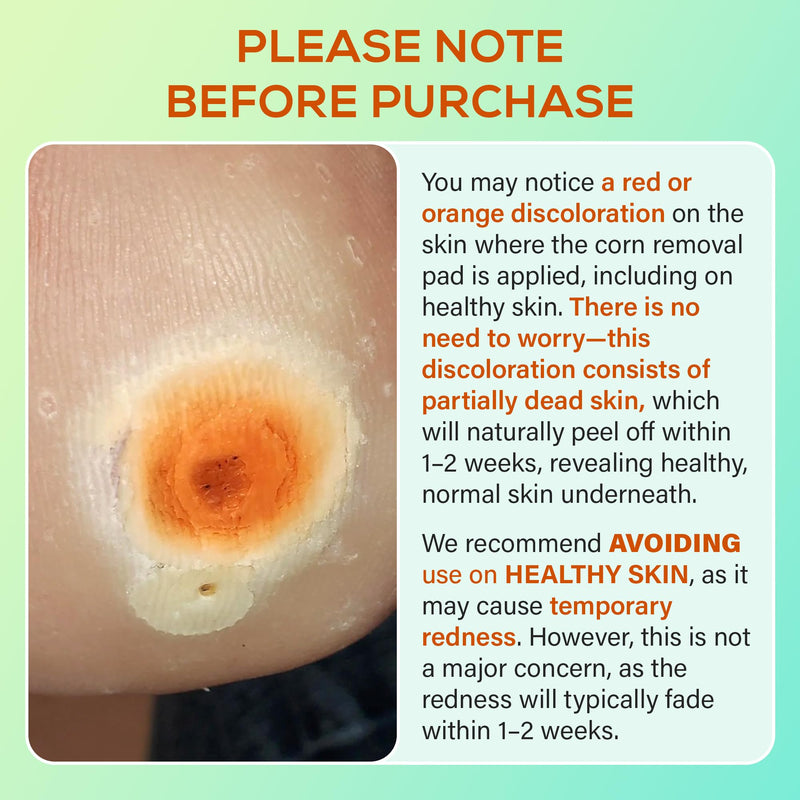 SupreH Corn Removers for Toes Feet Bandages: Corn Cushions and Small Callus Removal with 40% Salicylic Acid Long Adhesive - for Adult Seniors Nurses Hikers Athletes Men Women Pads 22 24 Pads - BeesActive Australia