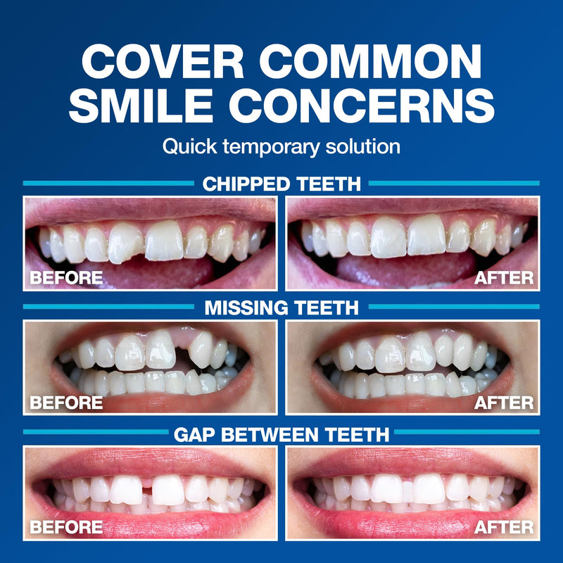 Imako Tooth Tinted Plastic - Natural Color - Temporary Tooth - Made in USA 1 Count (Pack of 1)