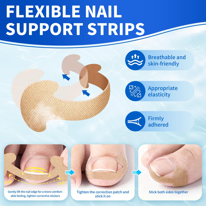 Ingrown Toenail Care Kit with Flexible Strips(134PCS), Professional Toenail Tool Kit Includes Breathable Toenail Bands, Curved Pads, Painless File & Lifter Tools | Home Pedicure Maintenance Set