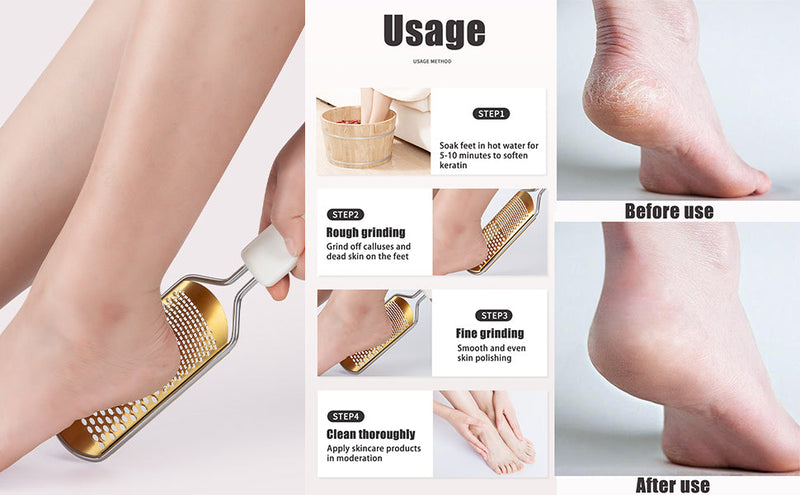 White Foot File Callus Remover, Foot File for Feet – Professional Pedicure Tool for Dead Skin Removal & Cracked Heels – Ultimate Stainless Steel Foot Scrubber for Soft, Healthy Feet White B