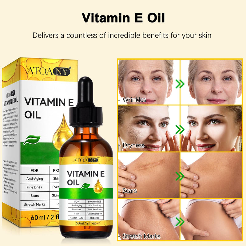 Vitamin E Oil 2 pack - 100% Pure Vitamin E Oil for Skin, Face, Hair, Body - Natural Antioxidant for Dryness, Wrinkles, Scars & Stretch Marks, Deep Hydration for Soft, Glowing Skin 2 Fl Oz (Pack of 2)