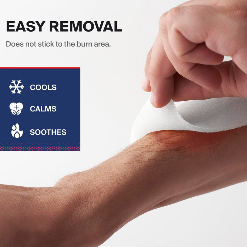 SurviveX Burn Dressing Kit with Tea Tree Oil - Hydrogel Burn Pads, Cooling Gels, Non-Adhesive Dressings & Gauze - Complete First Aid Accessory for Instant Cooling, Soothing & Burn Relief