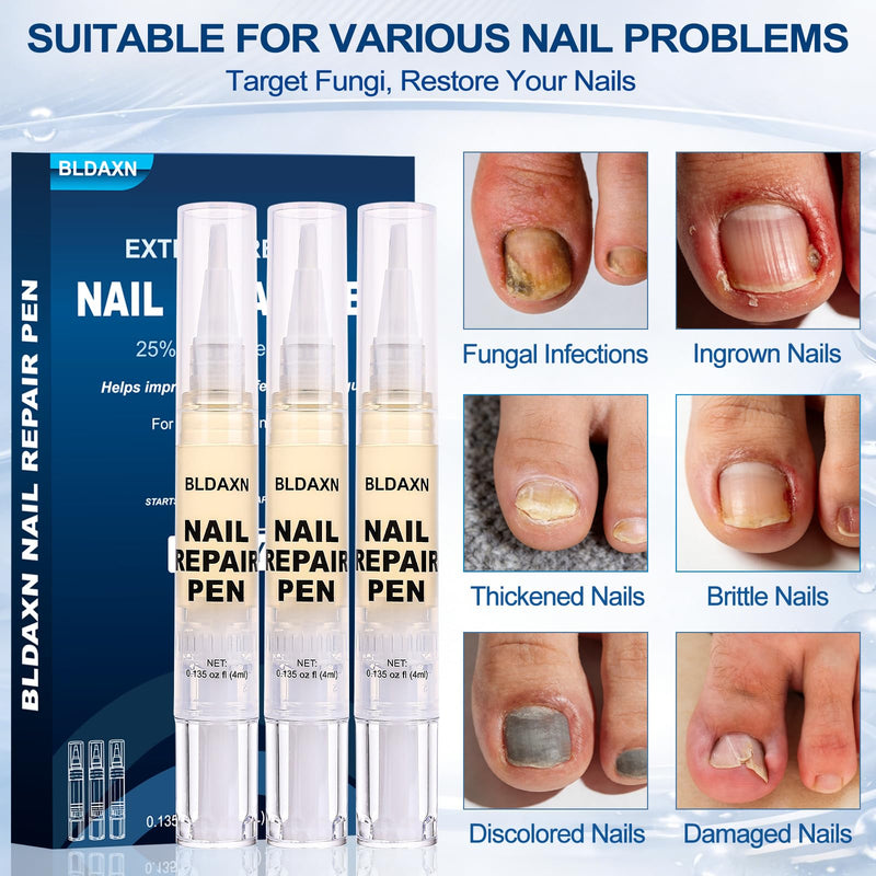 Toenail Fungus Treatment Extra Strength, Toenail Fungus Pen with 25% Undecylenic Acid for Toenails & Fingernails, Fungal Toe Nail Repair Pen for Damaged Nails, Ingrown Nails & Discoloration, 3Pcs 0.05 Fl Oz (Pack of 3)