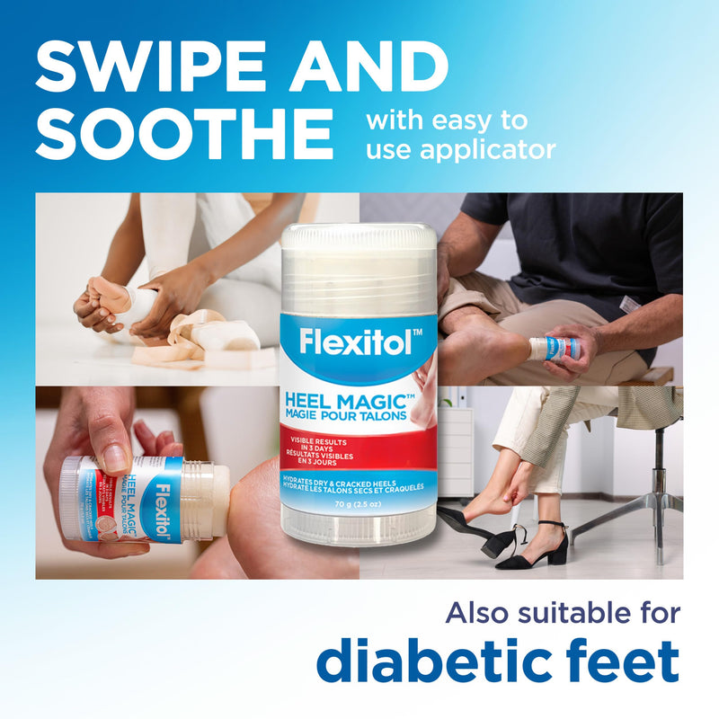 Flexitol Heel Magic Stick, Cracked Heel Cream & Foot Balm, Urea-Based Moisturizing Stick with Shea Butter & Vitamin E, 2.5 oz 2.5 Fl Oz (Pack of 1)