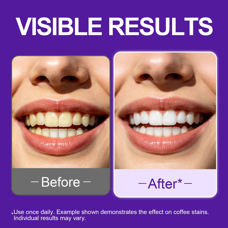 Teeth whitening Strips, Pap Formula Purple Whitening, Gentle Formula 2 Count (Pack of 28)