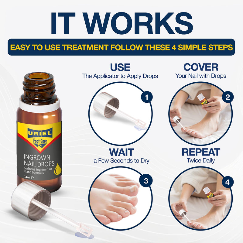 URIEL UPGRADED Ingrown Toenail Treatment, Ingrown Toenail Removal Kit, Ingrown Toenail Corrector, Ingrown Nail Kit Ingrown Toenail Tool 20ml 0.68 Fl Oz (Pack of 1)