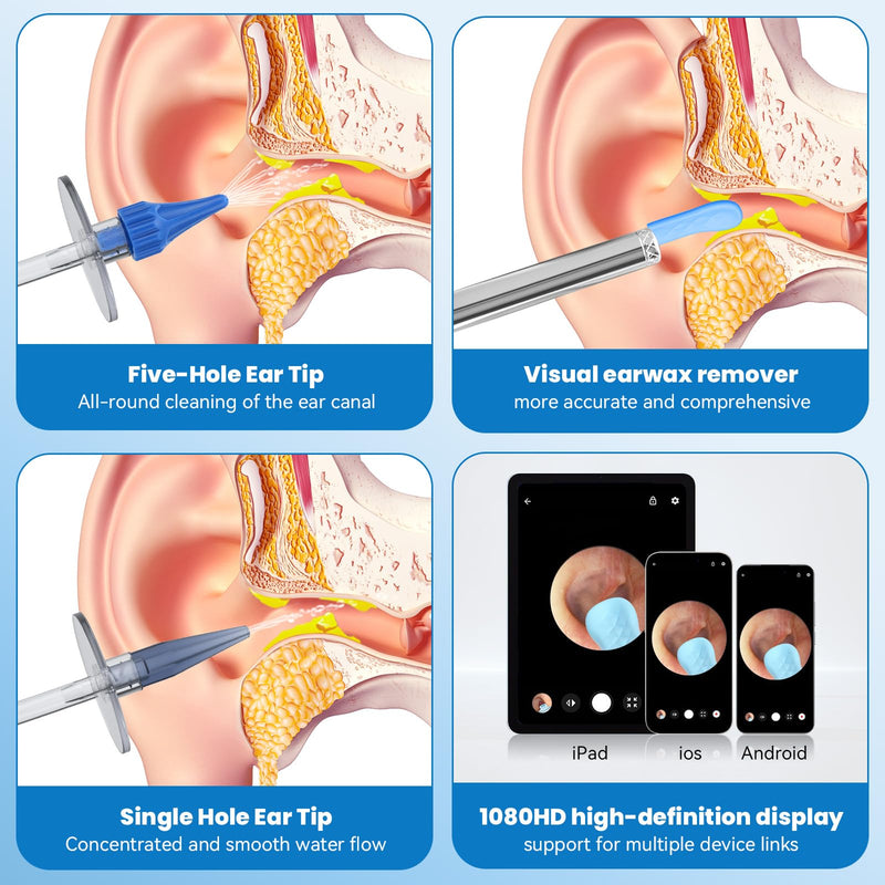 Ear Wax Removal - Ear Cleaner - Ear Camera - FSA HSA Eligible - Ear Wax Removal Kit - Ear Wax Removal Tool Camera - 1080HD Effective for Cleaning Ear Wax Build-Up - BeesActive Australia