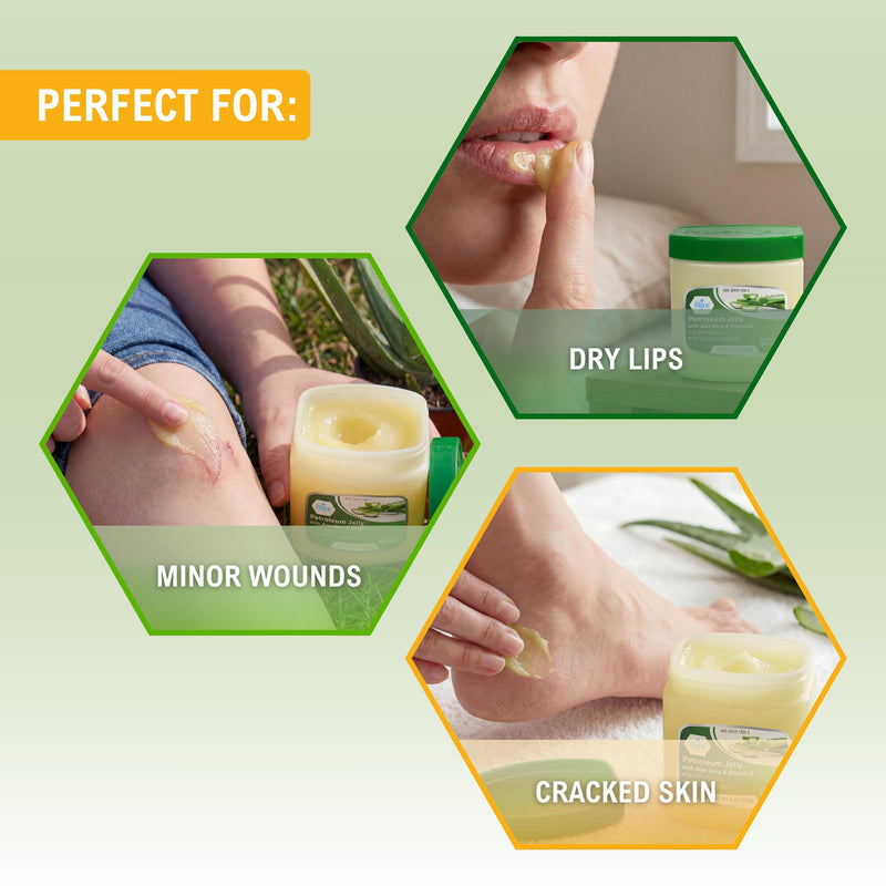 MED PRIDE Petroleum Jelly with Aloe Vera & Vitamin E, Protectant, 8 oz 8 Ounce (Pack of 1)