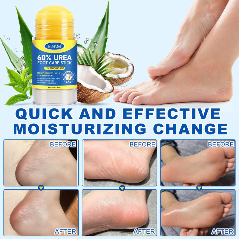 FANSHI 2 PCS Urea Stick 60% High Potency, Foot Care Urea Stick for Deeply Moisturizing & Fast Absorbing, Exfoliation for Dry Cracked Heels & Thickened Skin 0.71 Fl Oz (Pack of 2) - BeesActive Australia
