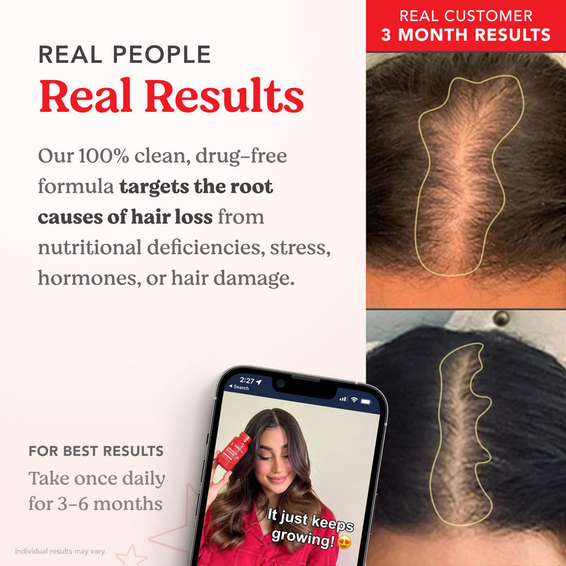 HAIRtamin Hair Vitamins with Biotin, Vegan Capsules, 1 Month Supply
