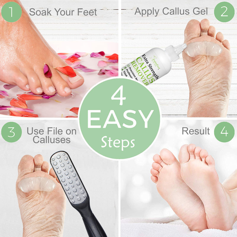 Callus Remover Gel & Double-Sided Foot File: 8 oz Extra Strength Callus Remover for Feet, Foot Callus Remover Care, Pedicure Tools Supplies, Spa Kit, Dead Skin Scrubber 8 oz Gel Double Sided File - BeesActive Australia