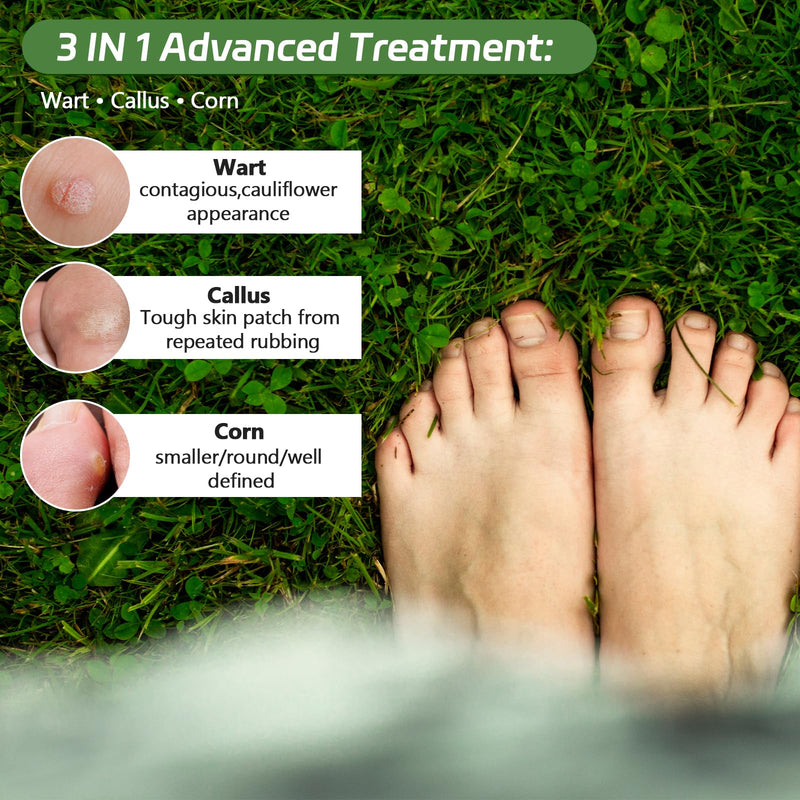 Corn Removers Pads for Feet & Toes - 40% Salicylic Acid Extra Strength Treatment, Maximum Adhesive Medicated Patches with All Day Protection - 30 Count 30 Count (Pack of 1) - BeesActive Australia