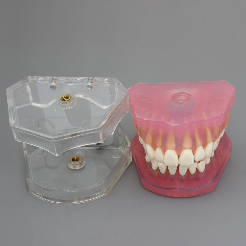 Dental Implant Teeth Model with Removable Teeth for Dental Professionals and Students - BeesActive Australia