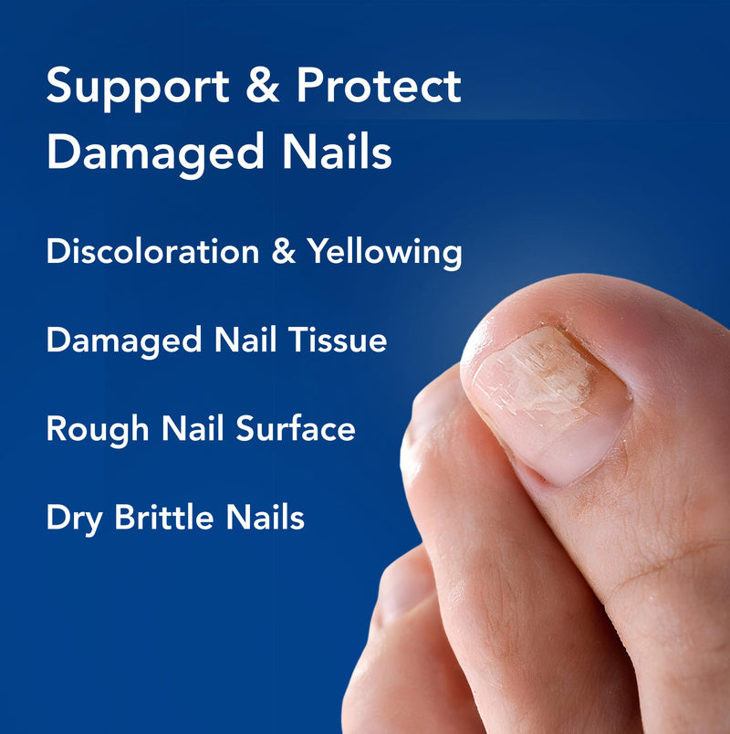 Nighttime Renewal Fungal Nail Patches - 36 Pack - Overnight Repair for Nail Fungus Damage, 8-Hour Treatment Restores Healthy Appearance