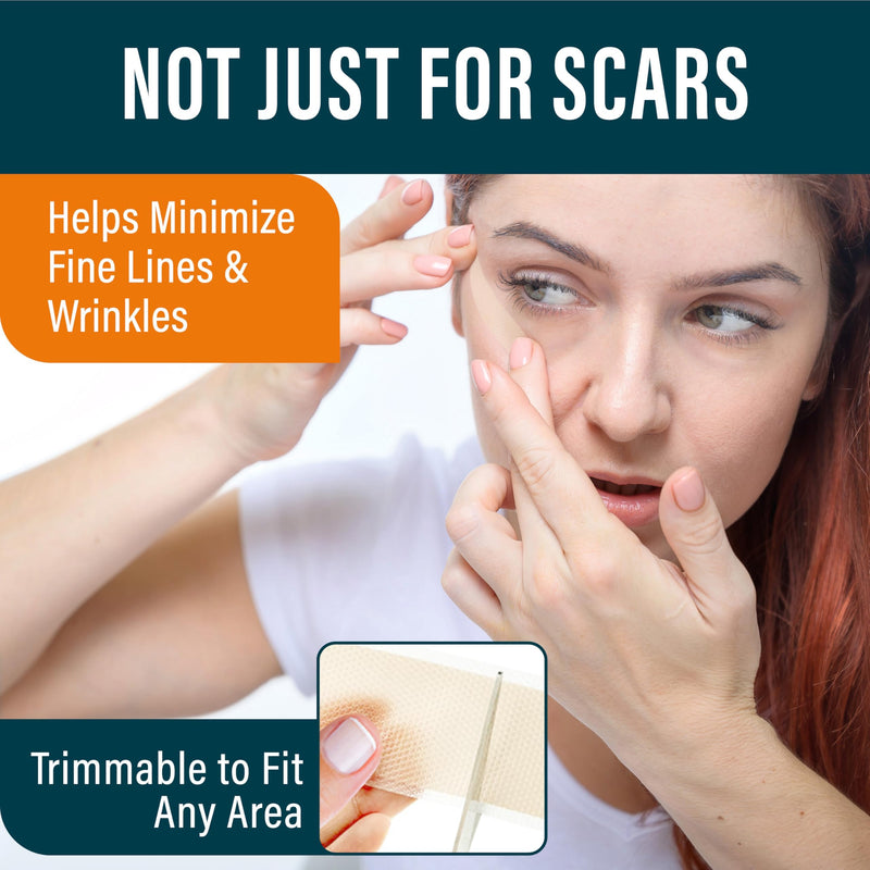 NUVADERMIS Silicone Scar Sheets for Surgical Scars - 120" x 1.5" Roll - Medical Grade Silicone Scar Tape and Face Tape for Wrinkles, Keloid Scars, and Hypertrophic Scars - Reusable - 1 Pack Scar Tape Light - 1 Pack