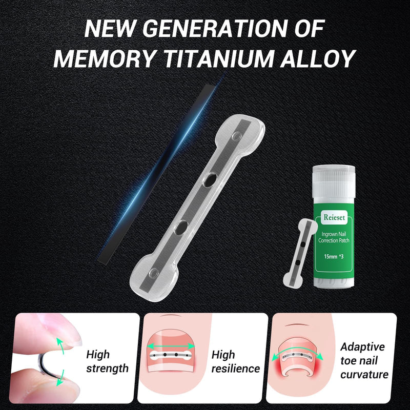Titanium Alloy Ingrown Toenail Corrector & Pain Relief Aid - Specially Designed Ingrown Toenail & Corrector Removal Kit for Curved Nail Repair and Removal (0.59/0.67in) 0.59/0.67in