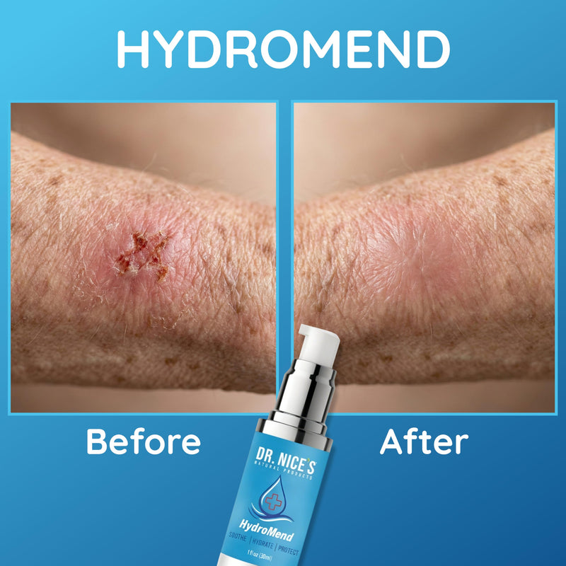 DR. NICE'S HydroMend for Seniors | for Chronic Wounds, Thin, Fragile or Dry Skin, Minor Cuts, Bumps and Bruises, Scrapes, Wounds, Chafe, Burns | Topical First-aid Hydrogel (30 ML) - BeesActive Australia