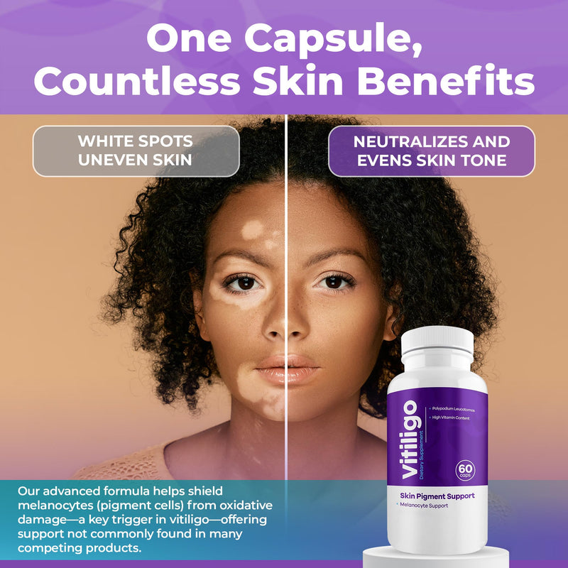 Vitiligo Capsules 60 Count | 1 Month | Improve Skin Pigmentation Support and Reduce White Spots | Effective Vitiligo Supplement | Natural Solution for White Spots on Skin. (3) 3