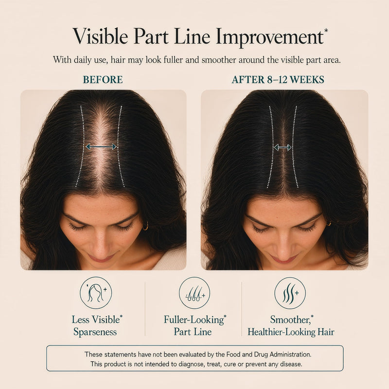 Hair Growth Supplements for Visibly Fuller, Thicker Hair and Supports Scalp | Clinically Tested for Women Ages 30 and Up, with 5,000mcg Biotin, Vitamins, Collagen & Arjuna, Stronger Hair, Skin & Nails