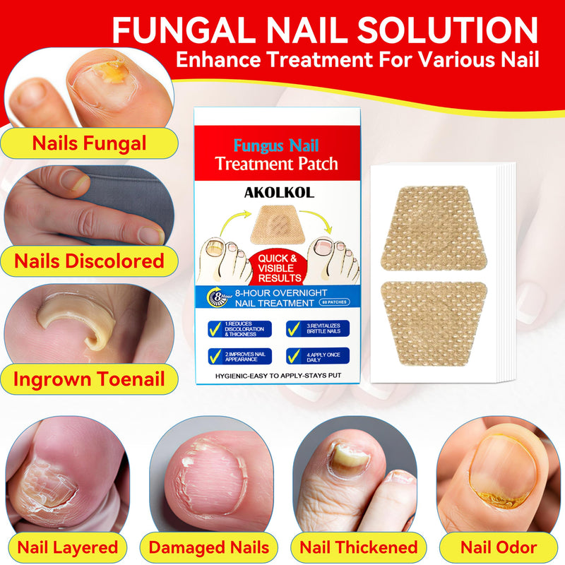 Toenail Fungus Treatment Extra Strength, 60 PCS Nail Repair Patches for Overnight, 8-Hour Fungal Nail Patches Renewal for Men and Women, Nail Fungus Treatments Patches Non-Falling Off Design White (60 pcs)