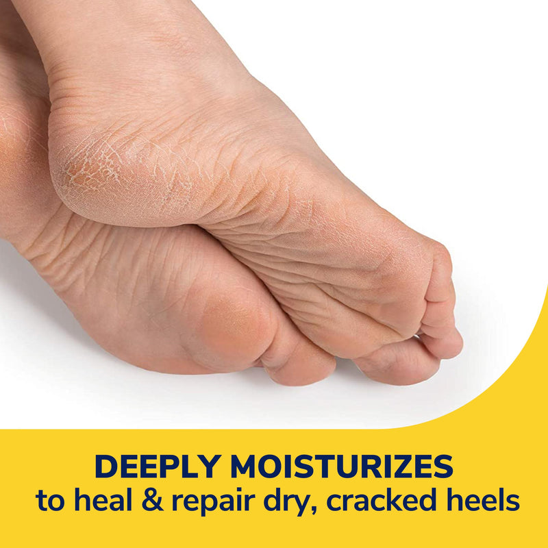 Dr. Scholl's Severe Cracked Heel Repair Restoring Balm 2.5oz, with 25% Urea for Dry, Cracked Feet, Heals and Moisturizes for Healthy Feet, Epsom Salt Soothes, Safe for Diabetics, 3-pack 1 Count (Pack of 3)