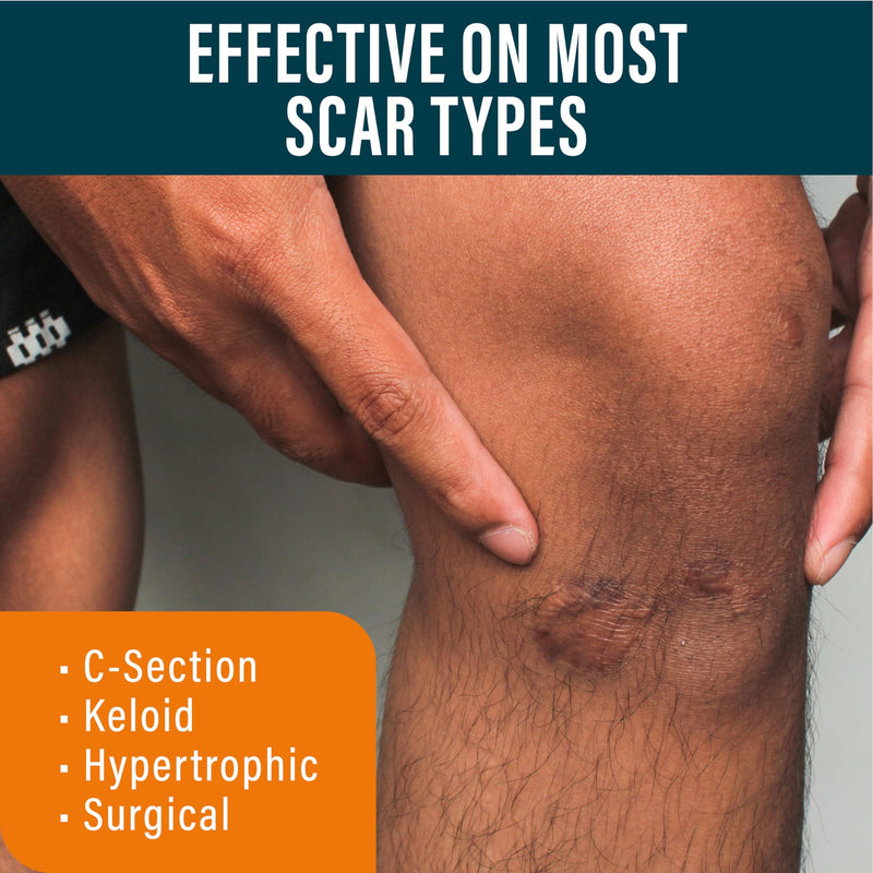 NUVADERMIS Scar Gel - Scar Cream for Surgical Scars - Transparent Gel Formula with Retinol and Vitamin E - Acne Scar Treatment, Keloid Scar Treatment, Scar Removal Cream - 1.7 Fl Oz, 1 Pack - BeesActive Australia
