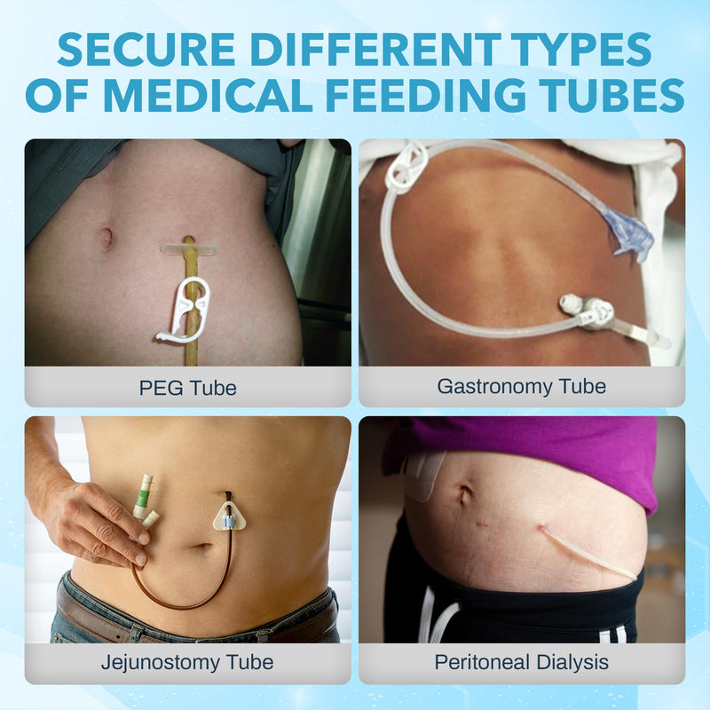 JJ Care Feeding Tube Belt (Small), Breathable PEG Tube Belt, Nylon Fabric Gtube Belt Compatible with PEG Tubes and Gastrostomy Tubes, Adjustable and Washable G Tube Holder - BeesActive Australia