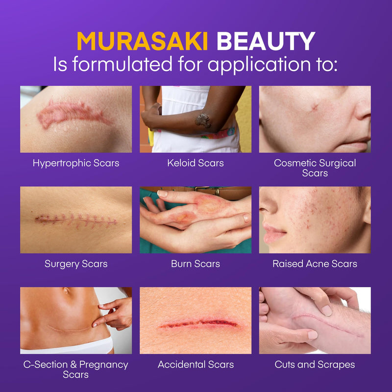 Silicone Scar Gel Scar Cream: SPF 30 Advanced Medical-Grade Formula for Surgical Scars, C-Section, Stretch Marks, Acne, Burns, Keloids, Old & New Scars – Broad Spectrum UV Protection 1.06oz (30g) - BeesActive Australia