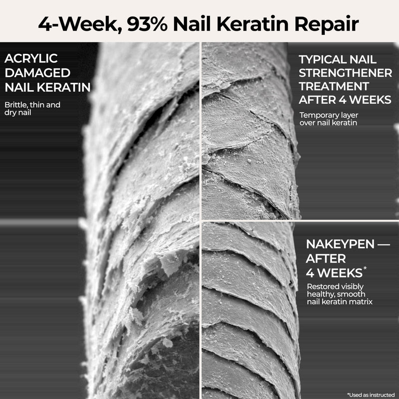 Fast-Absorbing Nail Strengthener for Weak, Thin & Post-Acrylic Damaged Nails - Perfect for Frequent Handwashing - Niacinamide, Keratin, Hyaluronic Acid & Peptides - 45 Day Supply by nakeyNails