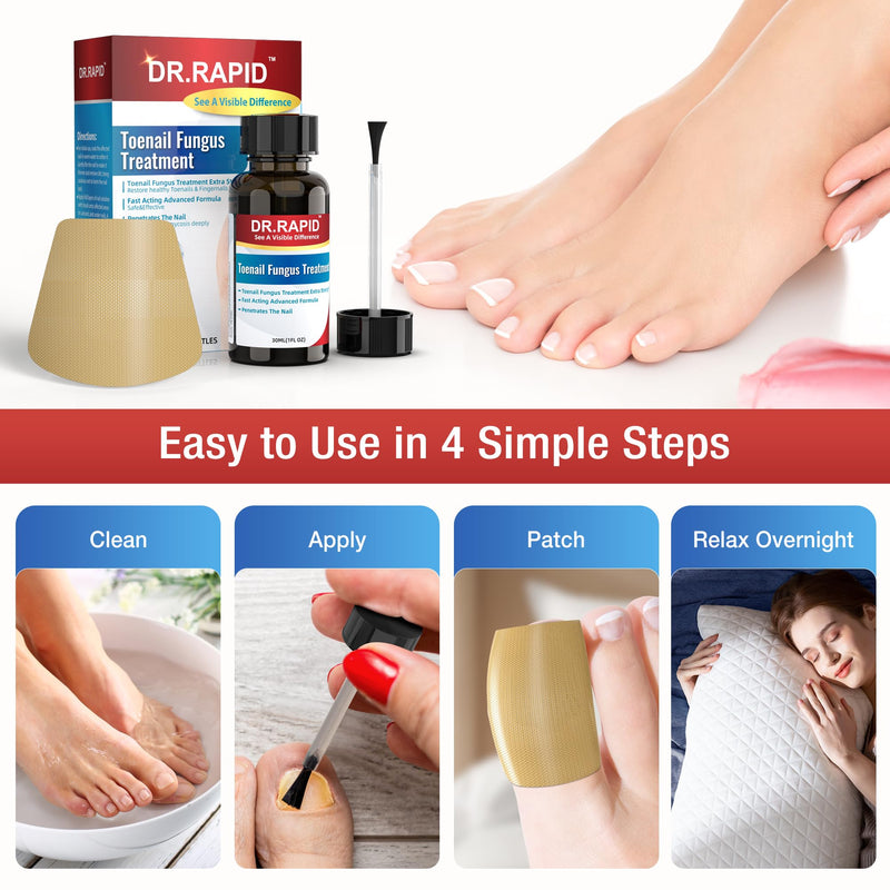 Toenail Fungus Treatment Extra Strength - 30mL Toenail Fungus Treatments Liquid & 20 Fungal Nail Patches Nail Repair for Damaged Nails, for Fungi Nails, Athletes Foot - Nail Care Kit 1 Count (Pack of 2) - BeesActive Australia