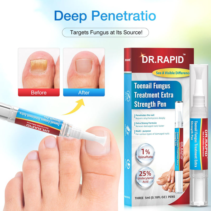 Toenail Fungus Treatment Extra Strength - Fungi Nail Pen Repair for Damaged Nails, Fast-Acting Solution for Toe & Fingernail Fungi, Ideal for Nail Health Concerns Athletes 5ml/0.18FLOZ 3Pcs
