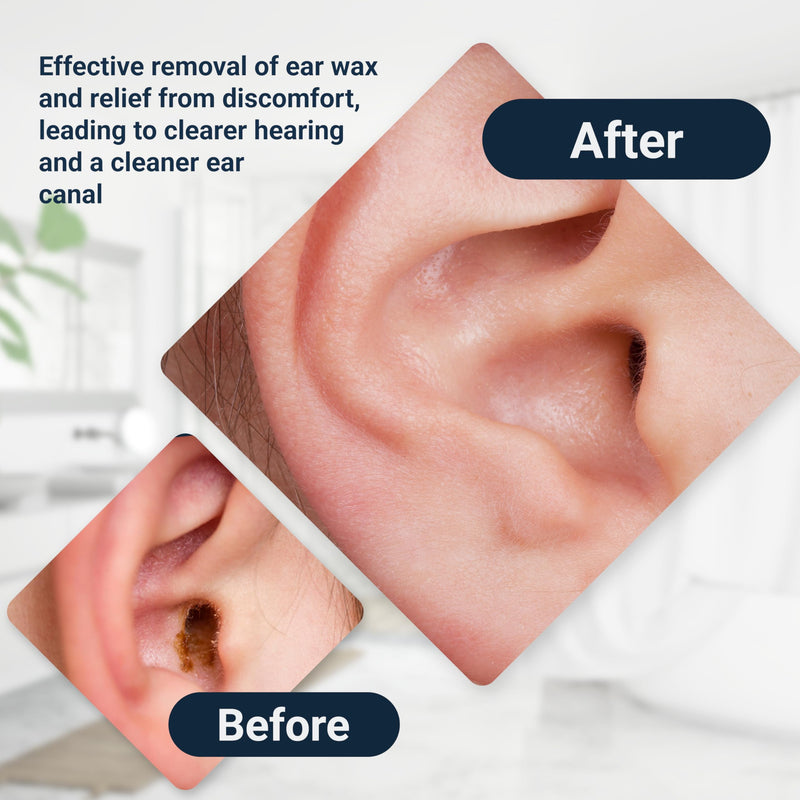 Elephant Ear Washer Bottle System By Doctor Easy - BeesActive Australia