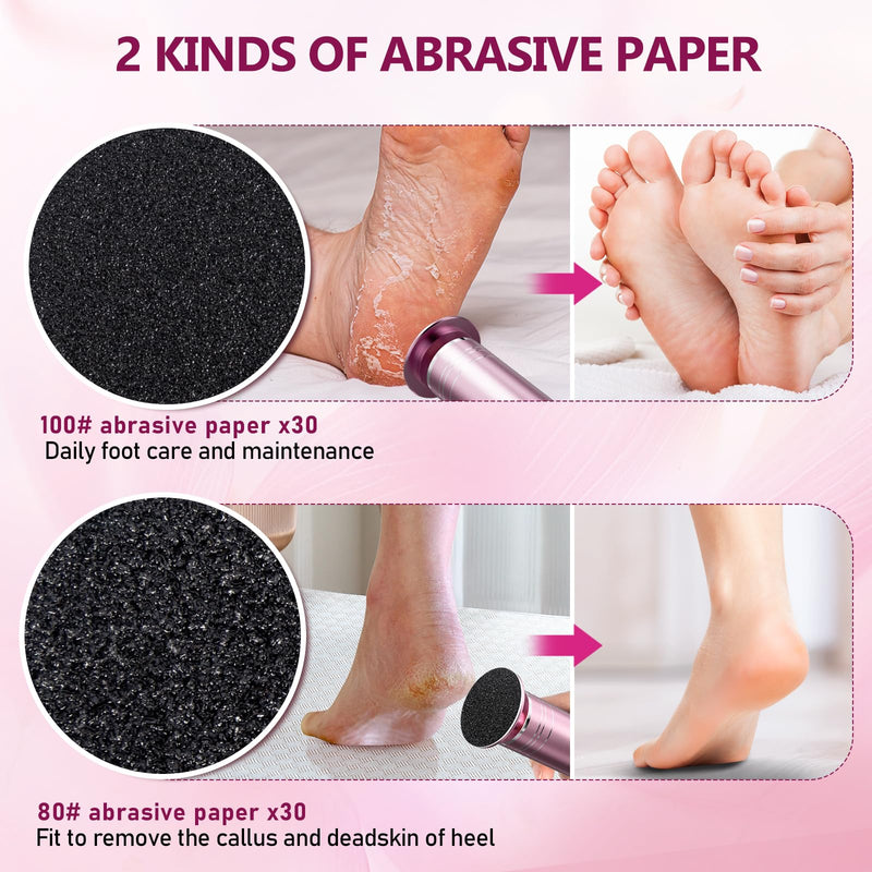 krofaue 1000RPM Electric Foot Callus Remover - Stepless Speed Control Foot Sander with 60pcs Replacement Sandpaper Disk, Electric Foot File Professional Pedicure Tool for Women Dead Cracked Hard Skin - BeesActive Australia