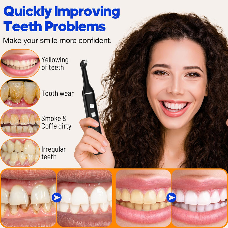 Tooth Polisher, RRZIOM Rechargeable Teeth Polisher for Teeth Whitening and Cleaning Kit, Waterproof Tooth Polish Dental Tools with LED Light, 5 Brush Heads, 5 Speed Modes, Tooth Polishing Kit Black-1 - BeesActive Australia