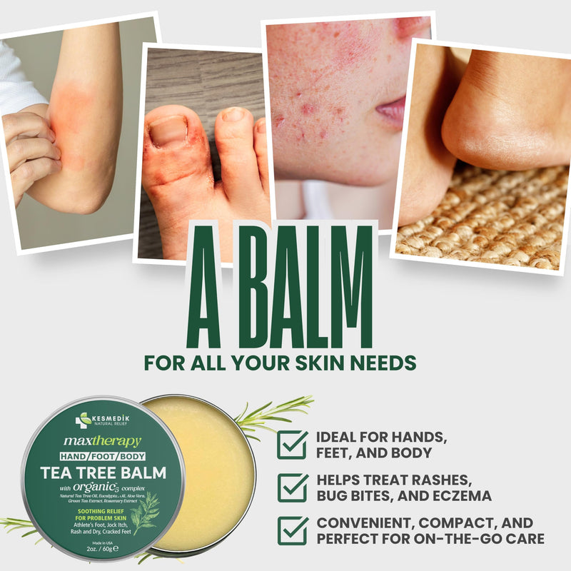 KESMEDIK Tea Tree Oil Balm for Skin, Soothes Itching, Rashes & Dry Skin, Antifungal Defense for Athlete’s Foot, Jock Itch, Chafing, Bug Bites & Eczema, Natural, Effective & Safe for All Ages 2 Ounce (Pack of 1)
