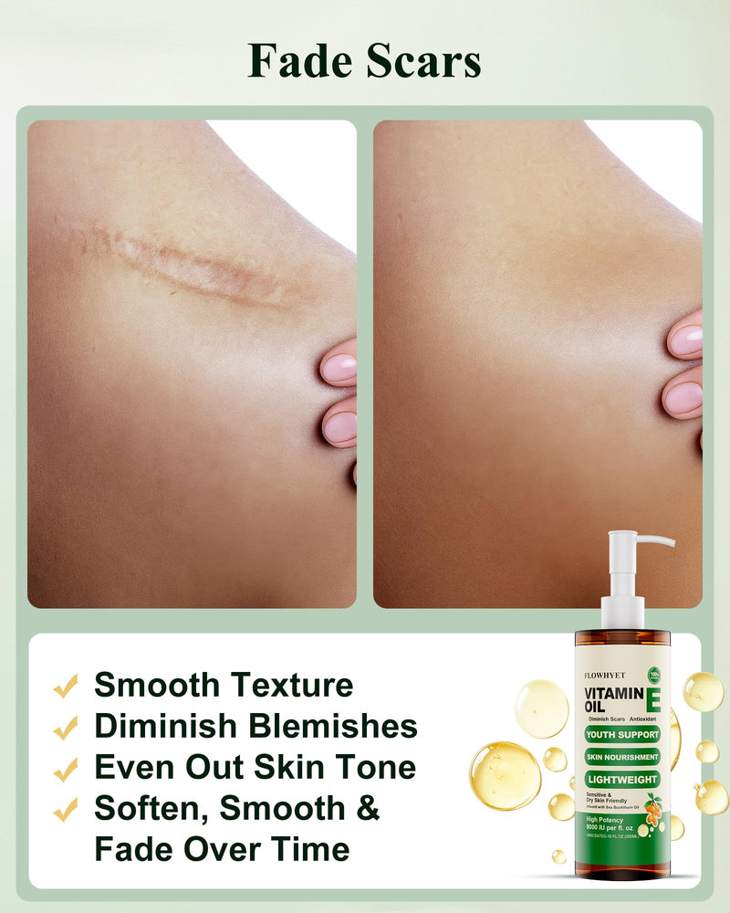 16 Fl oz Pure Vitamin E Oil For Skin Daily Body Care - 500mL | Natural vit e Nail Oil for Face, Skin, Body and Hair, Maintain Youthful, Nourish Dry Skin, Antioxidant, Fade Scars 16 Fl Oz (Pack of 1)