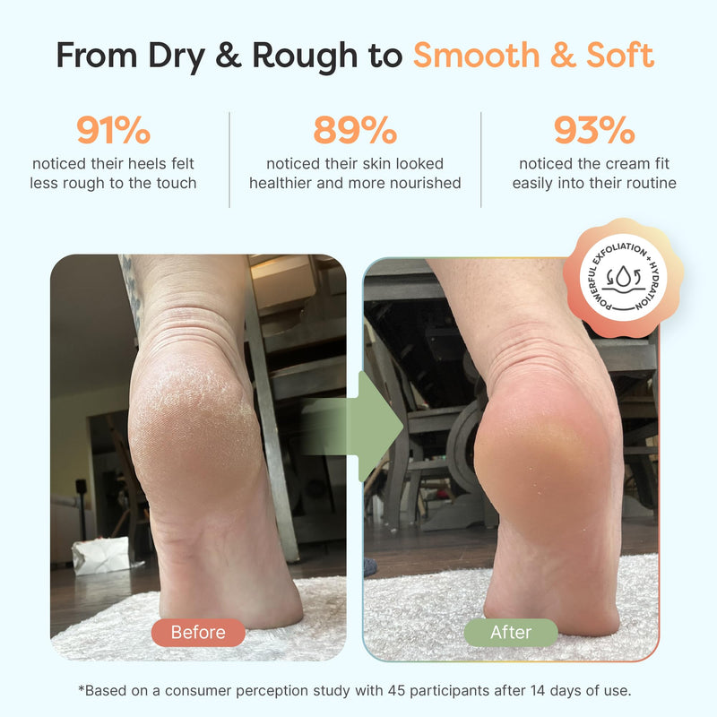ZenToes Urea Cream 40 Percent for Feet | Foot Lotion for Dry Cracked Heels and Feet | Intense Dry Feet Softening and Hydration for Skin | Heel Balm and Moisturizing Care | 5oz 5 Fl Oz (Pack of 1) - BeesActive Australia