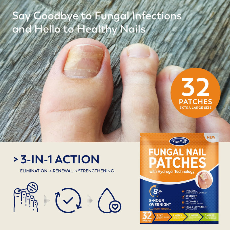 Toenail Fungus Treatment Extra Strength - (Medium) 32 Nighttime Hydrogel Patches for Overnight Toenail Repair - Visible Results in 8 Hours - Fungal Nail Patches for Toenail Fungus Relief 32 Count (Pack of 1)