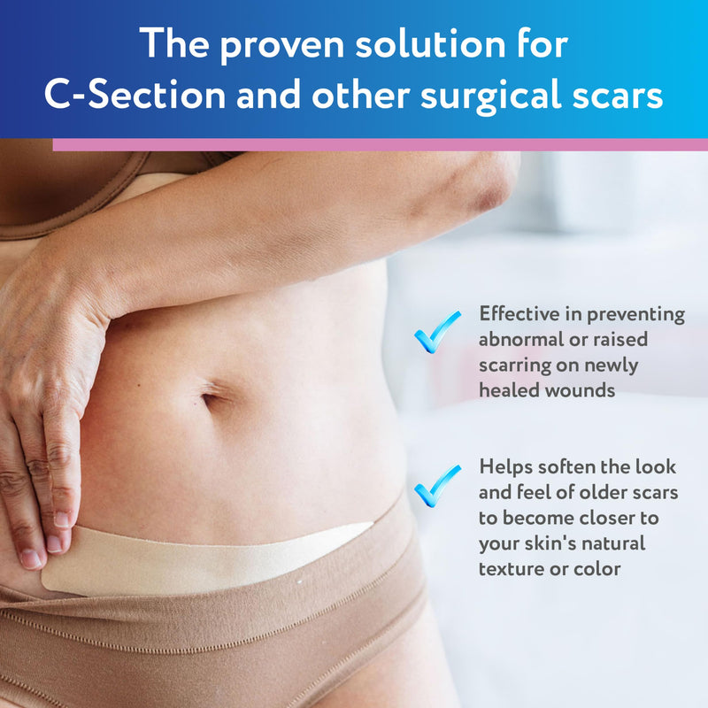 ScarAway Advanced Silicone Scar Sheets for C-Section, Reusable Strips (1.5” x 7”) for Hypertrophic and Keloid Scars from C-Section & Other Surgeries, 4 Sheets - BeesActive Australia