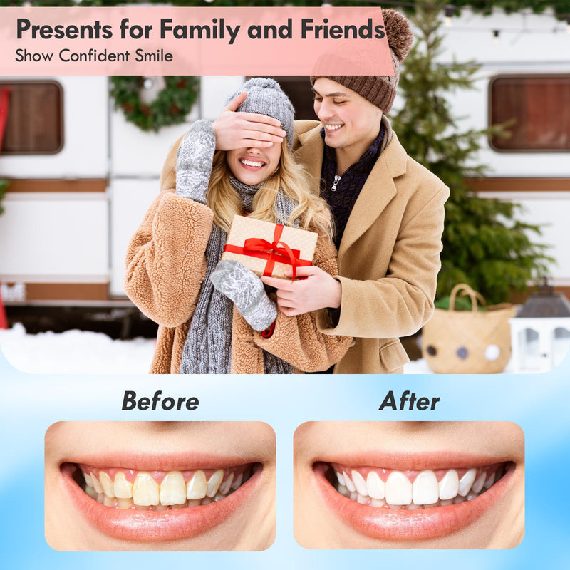 Tooth Polisher, Rechargeable Teeth Polisher for Daily Cleaning, Whitening and Polishing, Electric Dental Teeth Polishing with LED Light, 5 Brush Heads, 5 Speed Modes, Waterproof 1 Count (Pack of 1) White