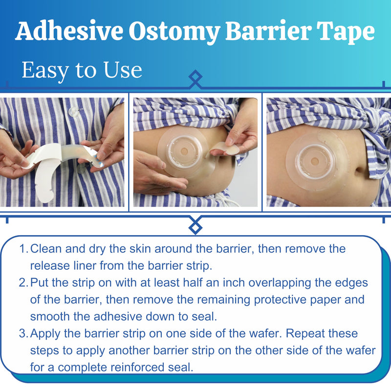 40PCS Ostomy Barrier Strips with Gaps, Elastic Ileostomy Urostomy Supplies, Skin Barrier Extender Tapes for Colostomy Bags - BeesActive Australia