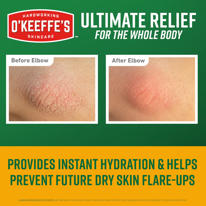O’Keeffe’s Skin Repair Ultimate Relief Body Cream, 7oz Tube (Pack of 1) – for the Most Severe Dry Skin - BeesActive Australia