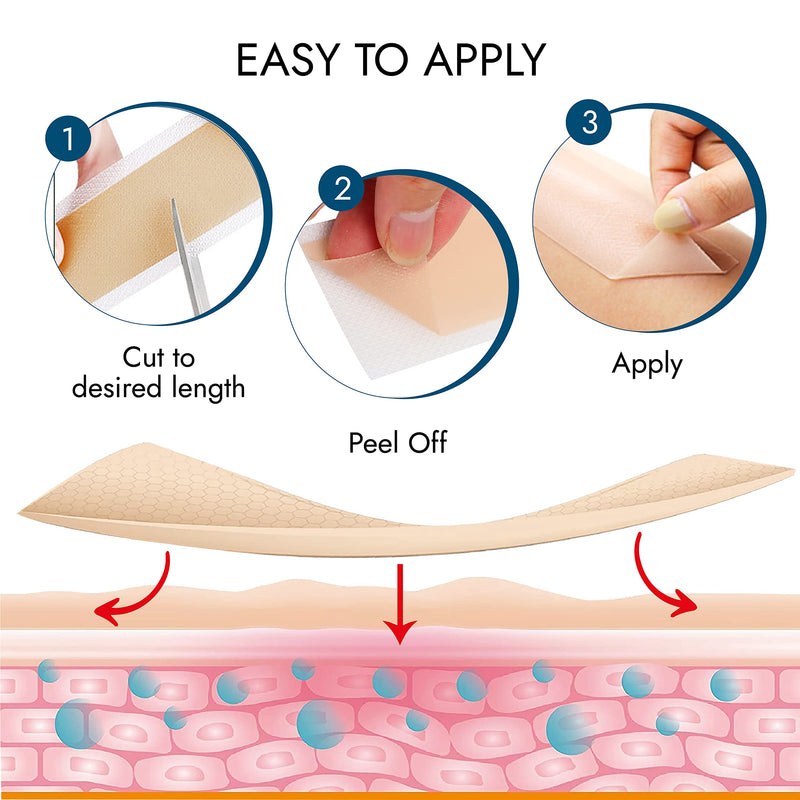 Scarbandit Silicone Scar Tape – Reusable Scar Sheets for Surgical Scars, Keloid Bump Removal, Burn, Acne Treatment, Stretch Mark Removal & c-Section – Waterproof & Breathable 118inch Scar Strips 1.57 x 118 Inch - BeesActive Australia