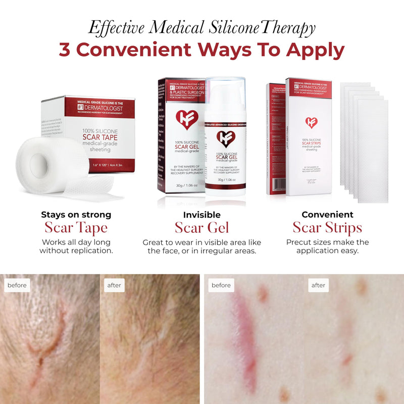 HealFast Physician Formulated Silicone Scar Sheets - Advanced Crosspolymer Medical Grade Silicone Scar Tape for Surgery, C Section, Keloids & Hypertrophic Scars - Silicone Tape For Scars - BeesActive Australia
