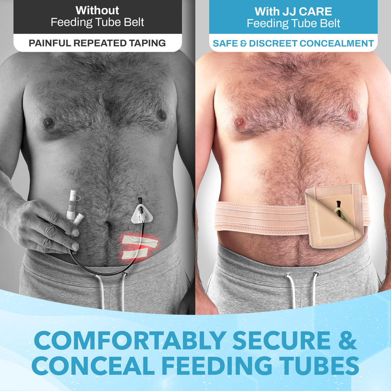 JJ Care Feeding Tube Belt (Small), Breathable PEG Tube Belt, Nylon Fabric Gtube Belt Compatible with PEG Tubes and Gastrostomy Tubes, Adjustable and Washable G Tube Holder - BeesActive Australia