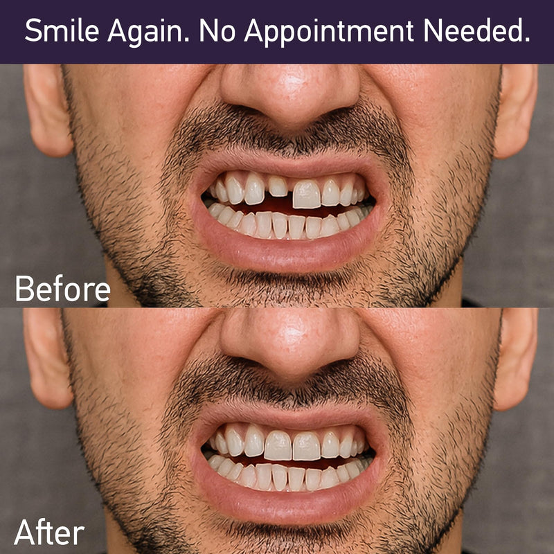 Dental Cement Kit – Zinc Oxide Eugenol Temporary Filling & Crown Repair | Tooth Repair Kit for Broken or Loose Caps, Bridges & Dentures | Strong Adhesive Glue | Instant Smile Fix | US Brand