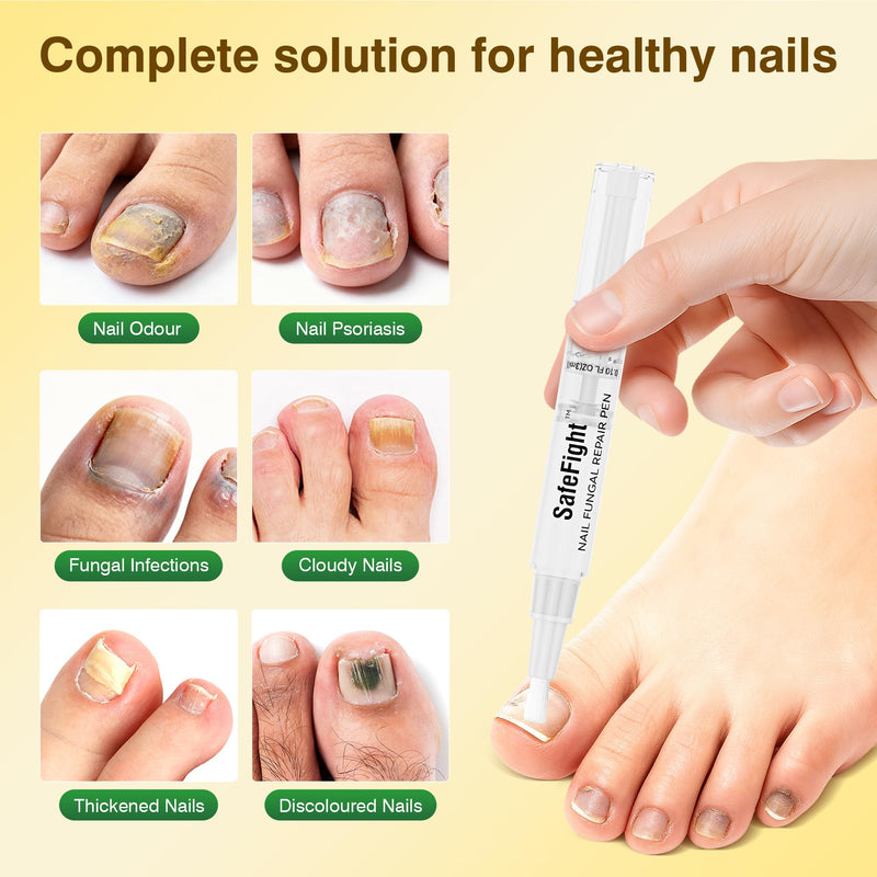Toenail Fungus Treatment Extra Strength - Nail Repair for Damaged Nails, Nail Repair with 25% Undecylenic Acid & Tolnaftate, Toenail Fungus Treatment for Fungal Toenail Fingernails & Athletes Foot - BeesActive Australia